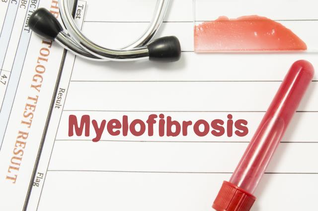 Myelofibrosis -- Image credit: shidlovski | stock.adobe.com