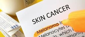 Product Storage and Dispensing of T-VEC in Melanoma