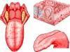 Tongue Stimulation Plus Cognitive, Physical Rehabilitation Induces Neuroplasticity in Multiple Sclerosis