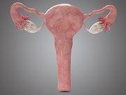 Early, Late Treatment May Increase Mortality Risk in Uterine Cancer