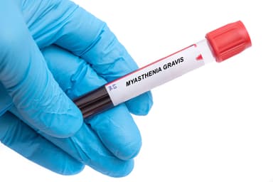 Myasthenia Gravis disease blood test in doctor hand