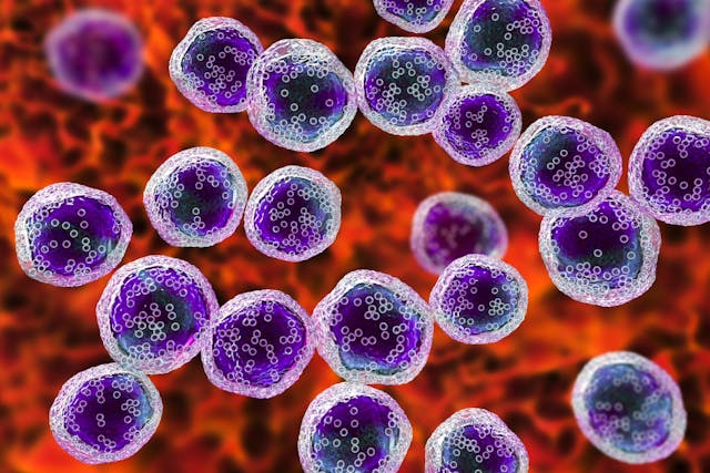 Diffuse Large B-Cell Lymphoma | Image Credit: Dr_Microbe - stock.adobe.com