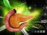 Immunotherapy Effective Against Aggressive Pancreatic Cancer