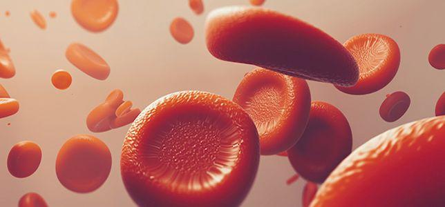 Concerns Rise Over Thrombotic Complications in Patients With COVID-19